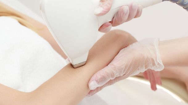 Laser-Haarentfernung mit ICE Diodenlaser am Arm – dauerhafte Haarentfernung.